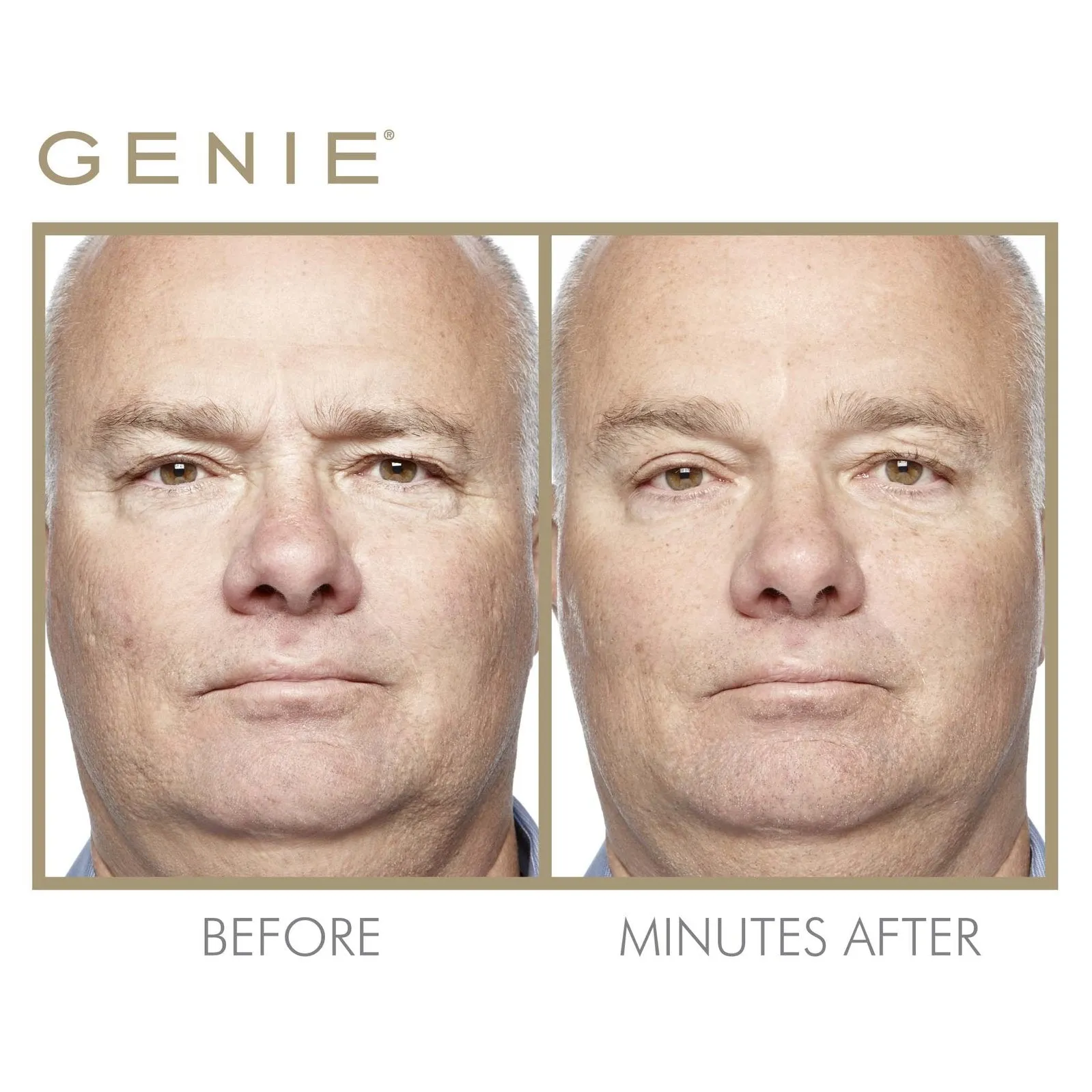 Instant Line Smoother, 19ml & 30ml
