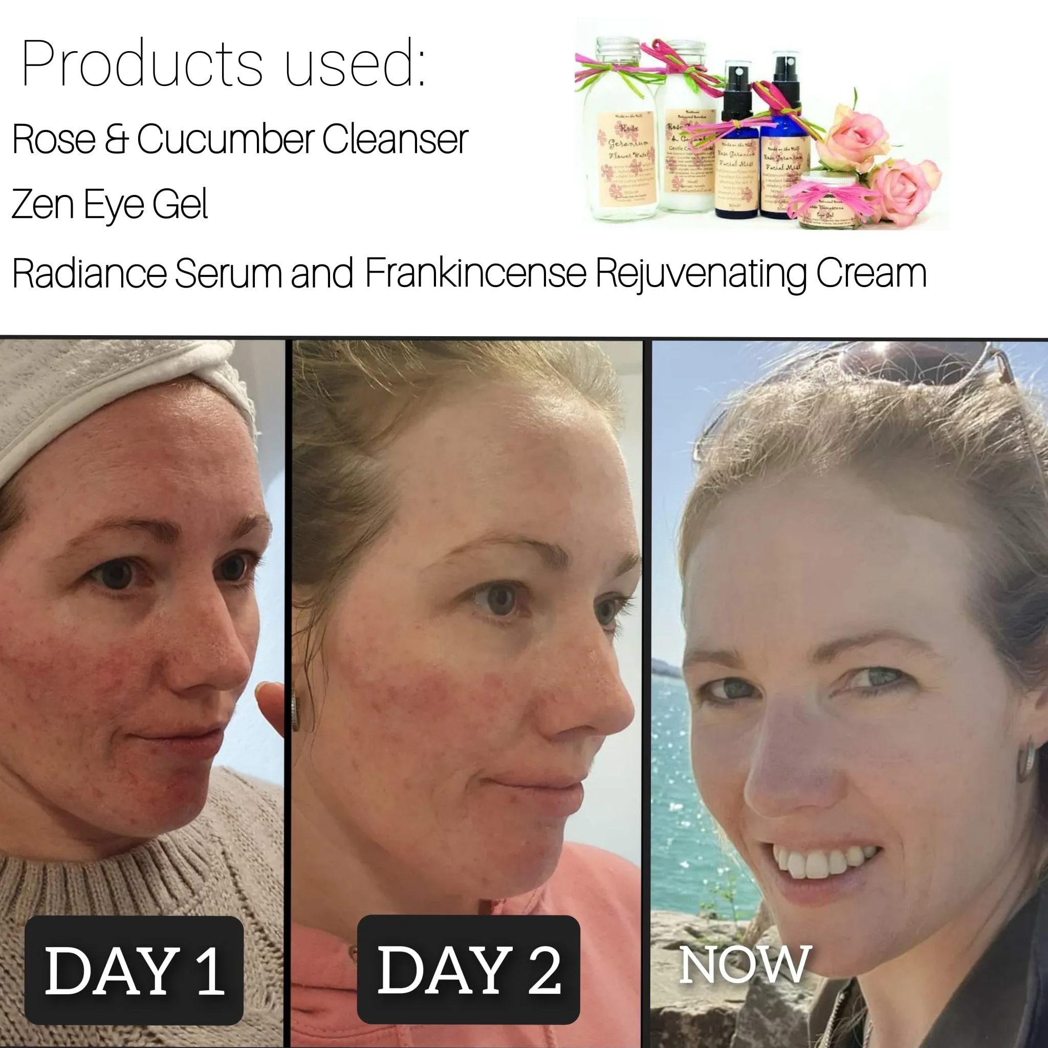 Radiance Gift Box
