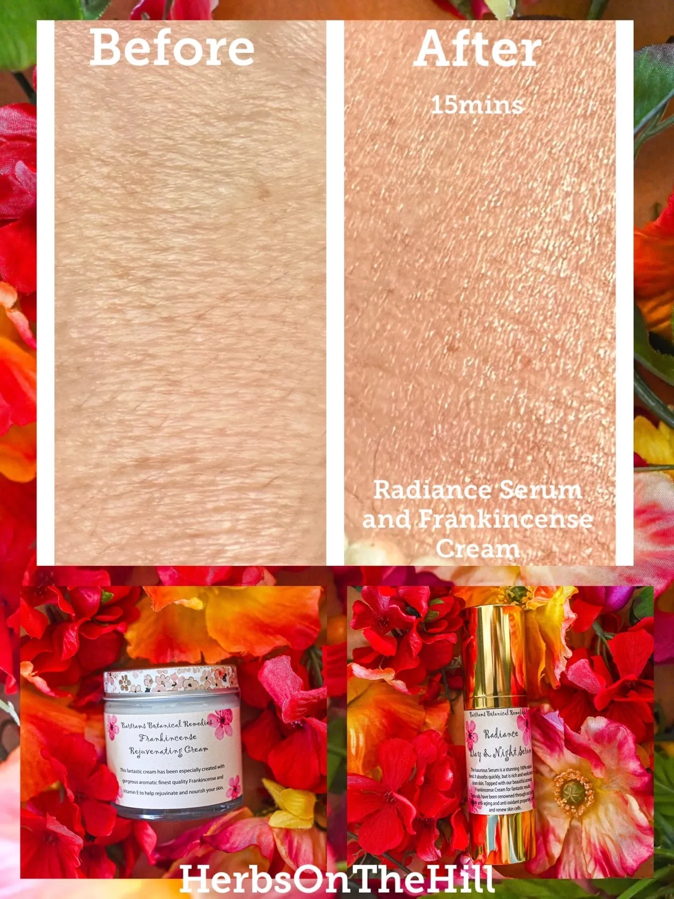 Radiance Gift Box