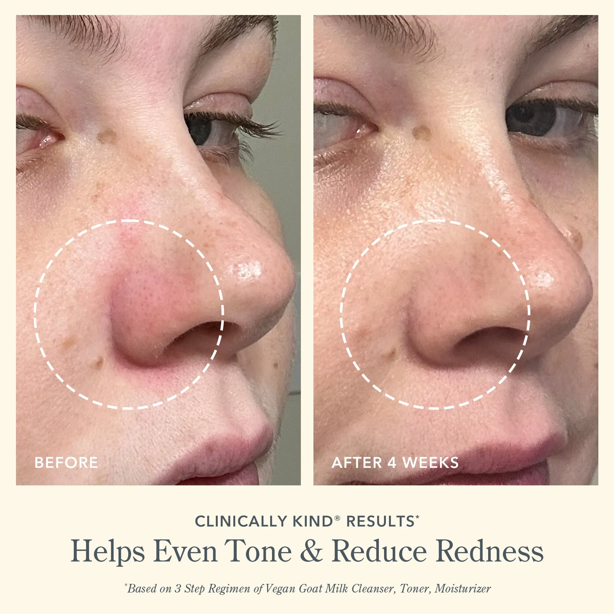 Redness Relief Starter Set
